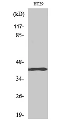 Anti-TBX10 antibody used in Western Blot (WB). GTX34257
