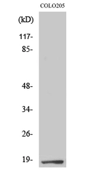 Anti-TCEAL1 antibody used in Western Blot (WB). GTX34258