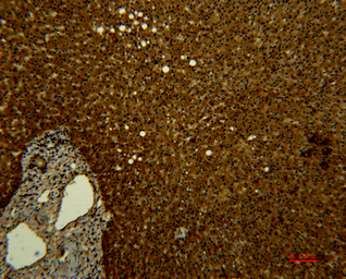 Anti-Transferrin antibody [10G3] used in IHC (Paraffin sections) (IHC-P). GTX34263