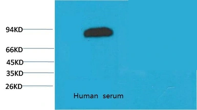 Anti-Transferrin antibody [10G3] used in Western Blot (WB). GTX34263