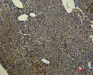 Anti-Transferrin antibody [3A5] used in IHC (Paraffin sections) (IHC-P). GTX34264