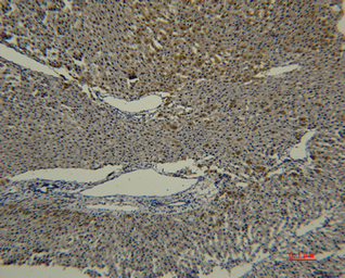Anti-Transferrin antibody [5E5] used in IHC (Paraffin sections) (IHC-P). GTX34266