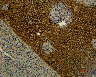 Anti-Transferrin antibody [5F9] used in IHC (Paraffin sections) (IHC-P). GTX34267