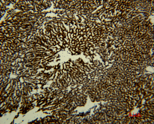 Anti-Transferrin antibody [5F9] used in IHC (Paraffin sections) (IHC-P). GTX34267