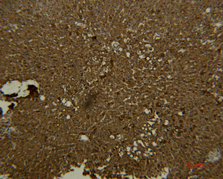 Anti-Transferrin antibody [7H11] used in IHC (Paraffin sections) (IHC-P). GTX34268