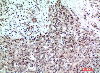 Anti-TP53INP2 antibody used in IHC (Paraffin sections) (IHC-P). GTX34279