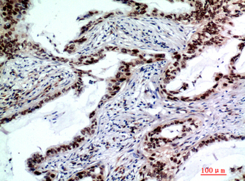 Anti-TP53INP2 antibody used in IHC (Paraffin sections) (IHC-P). GTX34279