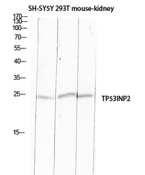 Anti-TP53INP2 antibody used in Western Blot (WB). GTX34279