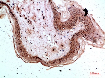 Anti-TPSD1 antibody used in IHC (Paraffin sections) (IHC-P). GTX34280