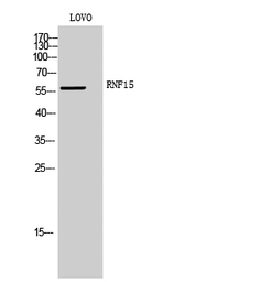 Anti-TRIM38 antibody used in Western Blot (WB). GTX34281
