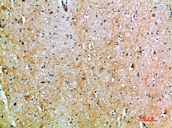 Anti-TSPAN7 antibody used in IHC (Paraffin sections) (IHC-P). GTX34283