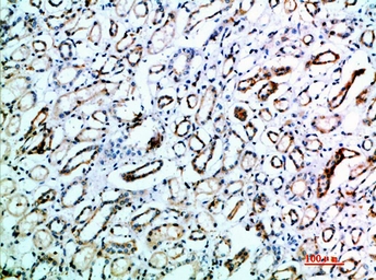 Anti-TSPAN7 antibody used in IHC (Paraffin sections) (IHC-P). GTX34283