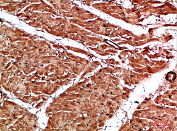 Anti-Titin antibody used in IHC (Paraffin sections) (IHC-P). GTX34284
