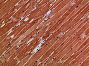 Anti-Titin antibody used in IHC (Paraffin sections) (IHC-P). GTX34284