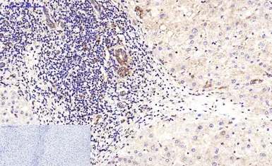 Anti-beta Tubulin I antibody [5G3] (HRP) used in IHC (Paraffin sections) (IHC-P). GTX34285