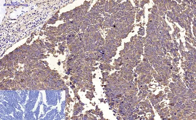 Anti-beta Tubulin I antibody [5G3] (HRP) used in IHC (Paraffin sections) (IHC-P). GTX34285