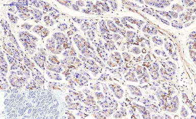 Anti-beta Tubulin I antibody [5G3] (HRP) used in IHC (Paraffin sections) (IHC-P). GTX34285