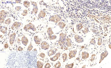 Anti-beta Tubulin I antibody [5G3] (HRP) used in IHC (Paraffin sections) (IHC-P). GTX34285