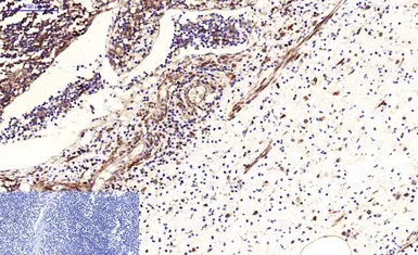 Anti-beta Tubulin I antibody [5G3] (HRP) used in IHC (Paraffin sections) (IHC-P). GTX34285