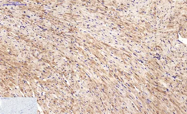 Anti-beta Tubulin I antibody [5G3] (HRP) used in IHC (Paraffin sections) (IHC-P). GTX34285