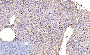 Anti-beta Tubulin I antibody [5G3] (HRP) used in IHC (Paraffin sections) (IHC-P). GTX34285