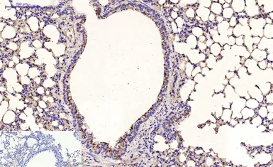 Anti-beta Tubulin I antibody [5G3] (HRP) used in IHC (Paraffin sections) (IHC-P). GTX34285