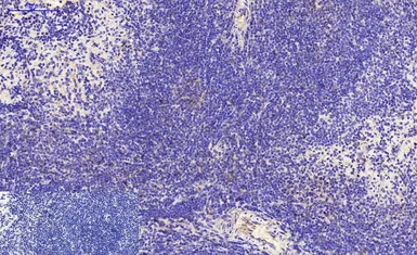 Anti-beta Tubulin I antibody [5G3] (HRP) used in IHC (Paraffin sections) (IHC-P). GTX34285
