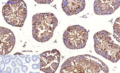 Anti-beta Tubulin I antibody [5G3] (HRP) used in IHC (Paraffin sections) (IHC-P). GTX34285