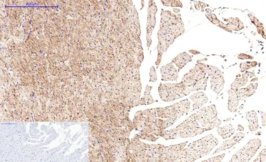 Anti-beta Tubulin I antibody [5G3] (HRP) used in IHC (Paraffin sections) (IHC-P). GTX34285