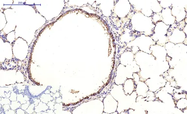 Anti-beta Tubulin I antibody [5G3] (HRP) used in IHC (Paraffin sections) (IHC-P). GTX34285