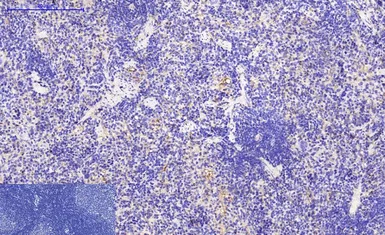 Anti-beta Tubulin I antibody [5G3] (HRP) used in IHC (Paraffin sections) (IHC-P). GTX34285