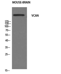 Anti-Versican antibody used in Western Blot (WB). GTX34292