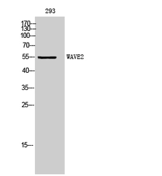 Anti-WASF2 antibody used in Western Blot (WB). GTX34295