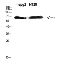 Anti-ZFP91 antibody used in Western Blot (WB). GTX34303