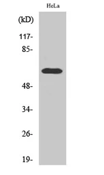 Anti-ZNF18 antibody used in Western Blot (WB). GTX34305