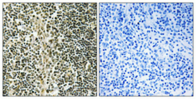 Anti-ZNF225 antibody used in IHC (Paraffin sections) (IHC-P). GTX34307