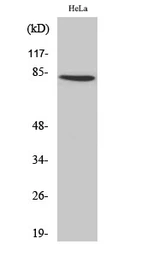 Anti-ZNF225 antibody used in Western Blot (WB). GTX34307