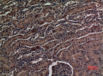 Anti-ZNF227 antibody used in IHC (Paraffin sections) (IHC-P). GTX34308