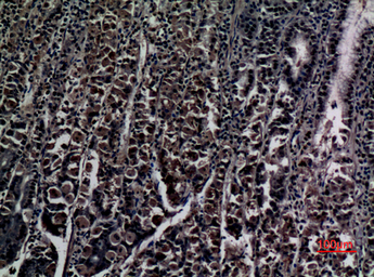Anti-ZNF227 antibody used in IHC (Paraffin sections) (IHC-P). GTX34308