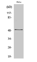 Anti-ZNF436 antibody used in Western Blot (WB). GTX34310