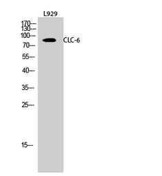 Anti-CLCN6 antibody used in Western Blot (WB). GTX34317