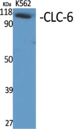 Anti-CLCN6 antibody used in Western Blot (WB). GTX34317