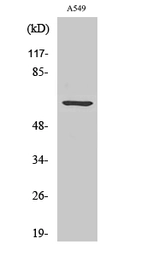 Anti-CLIP3 antibody used in Western Blot (WB). GTX34318