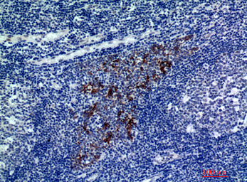 Anti-CMTM8 antibody used in IHC (Paraffin sections) (IHC-P). GTX34321