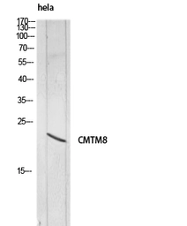 Anti-CMTM8 antibody used in Western Blot (WB). GTX34321