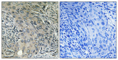 Anti-COPZ1 antibody used in IHC (Paraffin sections) (IHC-P). GTX34326