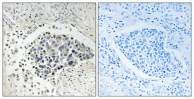 Anti-CPNE8 antibody used in IHC (Paraffin sections) (IHC-P). GTX34329