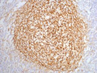 Anti-CD21 antibody [2C5] used in IHC (Paraffin sections) (IHC-P). GTX34330
