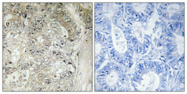 Anti-Cystatin SN antibody used in IHC (Paraffin sections) (IHC-P). GTX34332