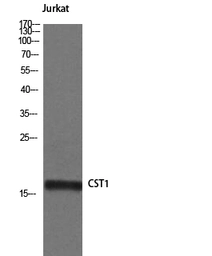 Anti-Cystatin SN antibody used in Western Blot (WB). GTX34332